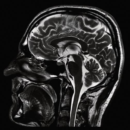 TotalView™ Brain Check