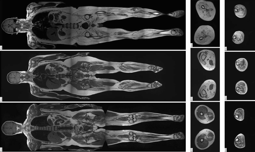 TotalView™ Whole-Body Scan 