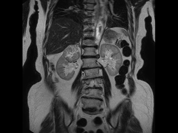 TotalView™ Abdomen-Pelvis 